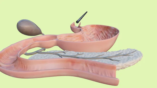 Gastroscopy