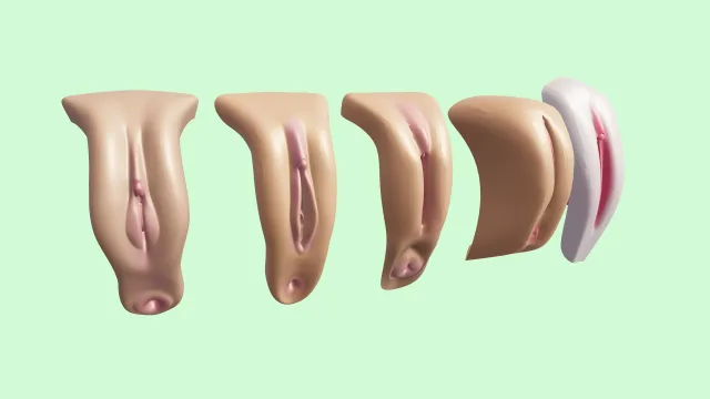 Female genitals